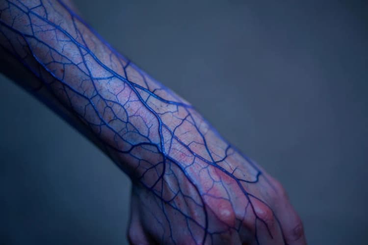 Veias azuis e roxas em forma de rede sob a pele translúcida de uma perna, detalhe ampliado.