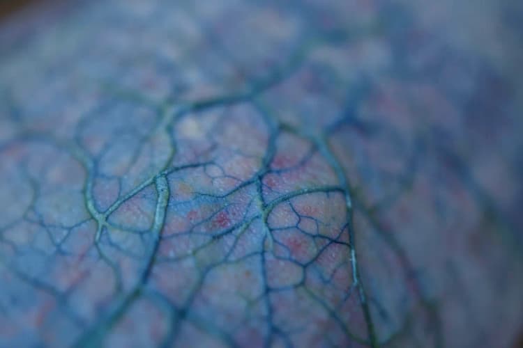 Veias azuis e verdes proeminentes sob a pele, com algumas áreas mais dilatadas.