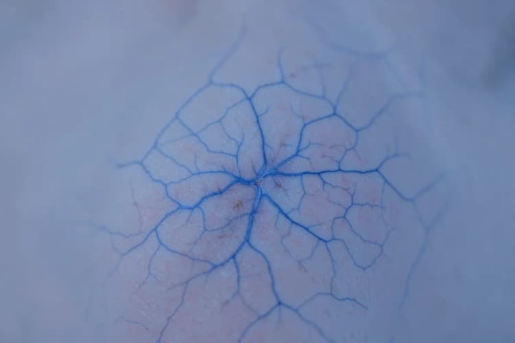 Close-up de veias azuis proeminentes sob a pele, simulando varizes.
