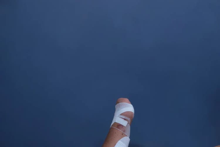 Pernas com curativos e faixas compressivas após cirurgia de varizes, com foco nas cicatrizes e na pele.